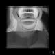 GHOSTEMANE - Dread